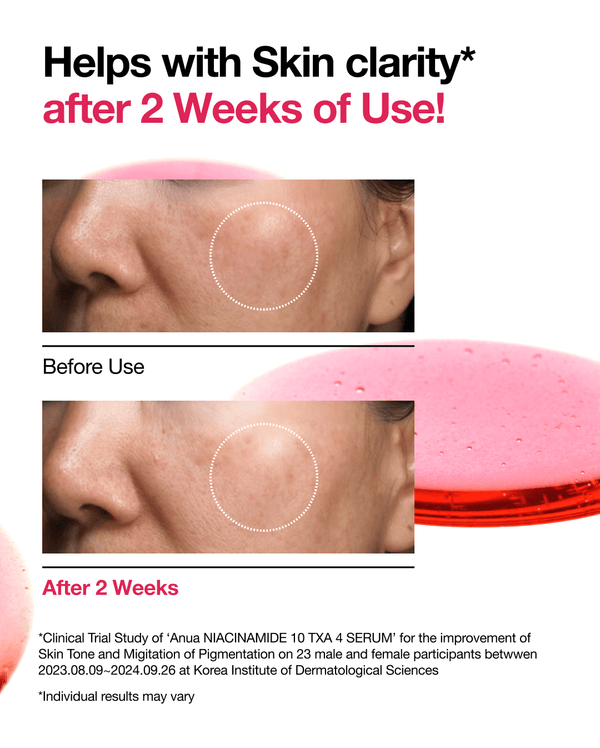 ANUA NIACINAMIDE 10%+TXA 4% SERUM (30ml/1 fl.oz)