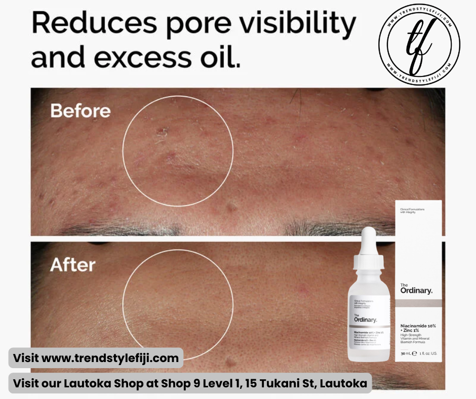 Ordinary Niacinamide 10% + Zinc 1% (30ml)