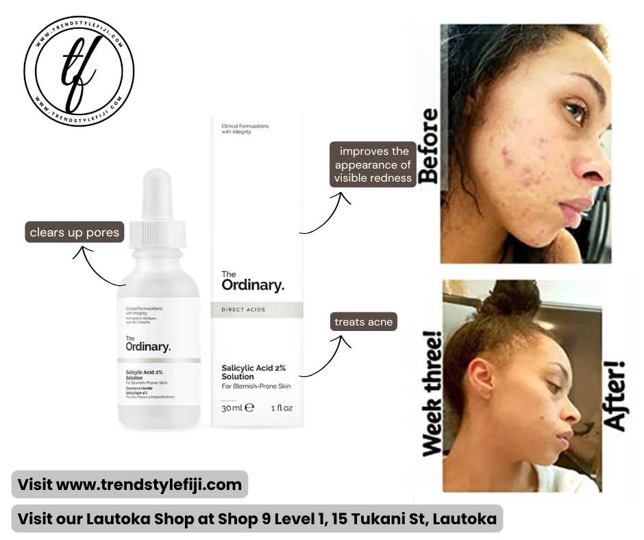 Ordinary Salicylic Acid 2% Solution (30ml)