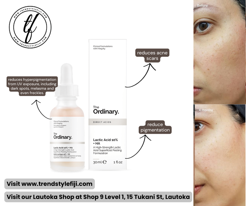 Ordinary Lactic Acid 10% + HA (30ml)