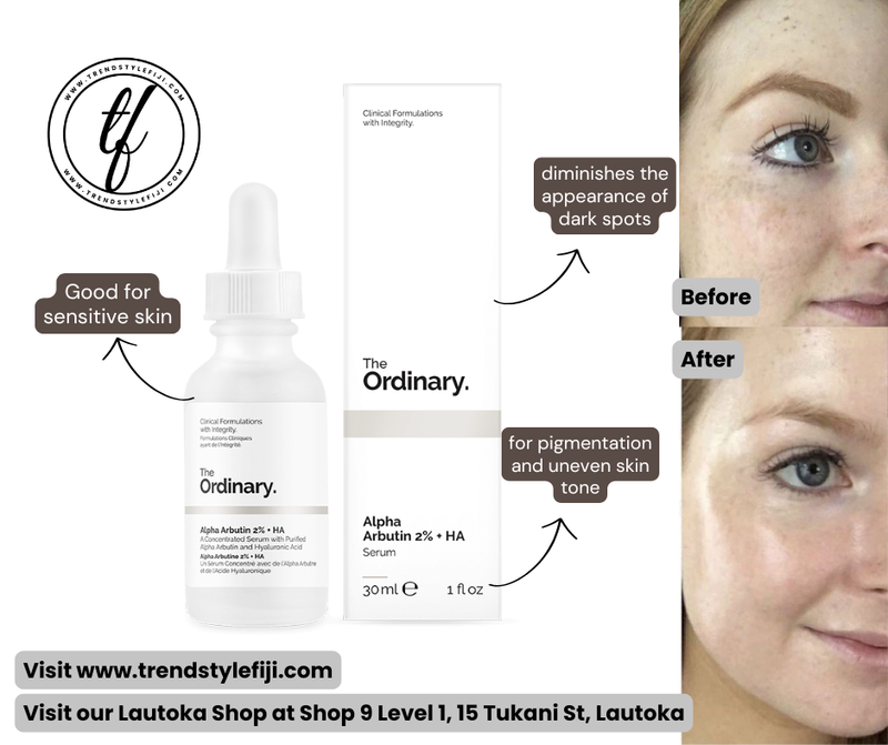 Ordinary Alpha Arbutin 2% + HA (30ml)